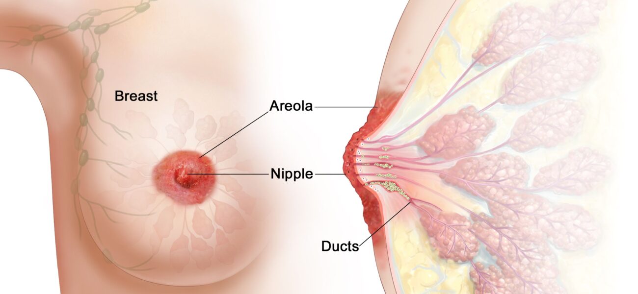 Lesions Paget’s Disease