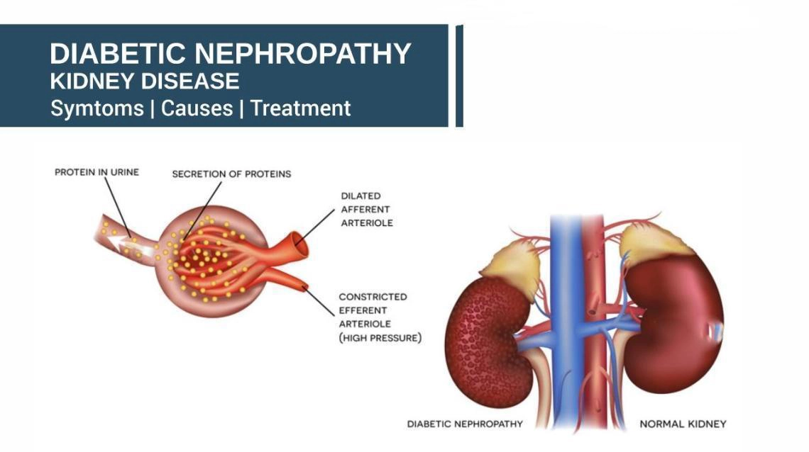 Nephropathy