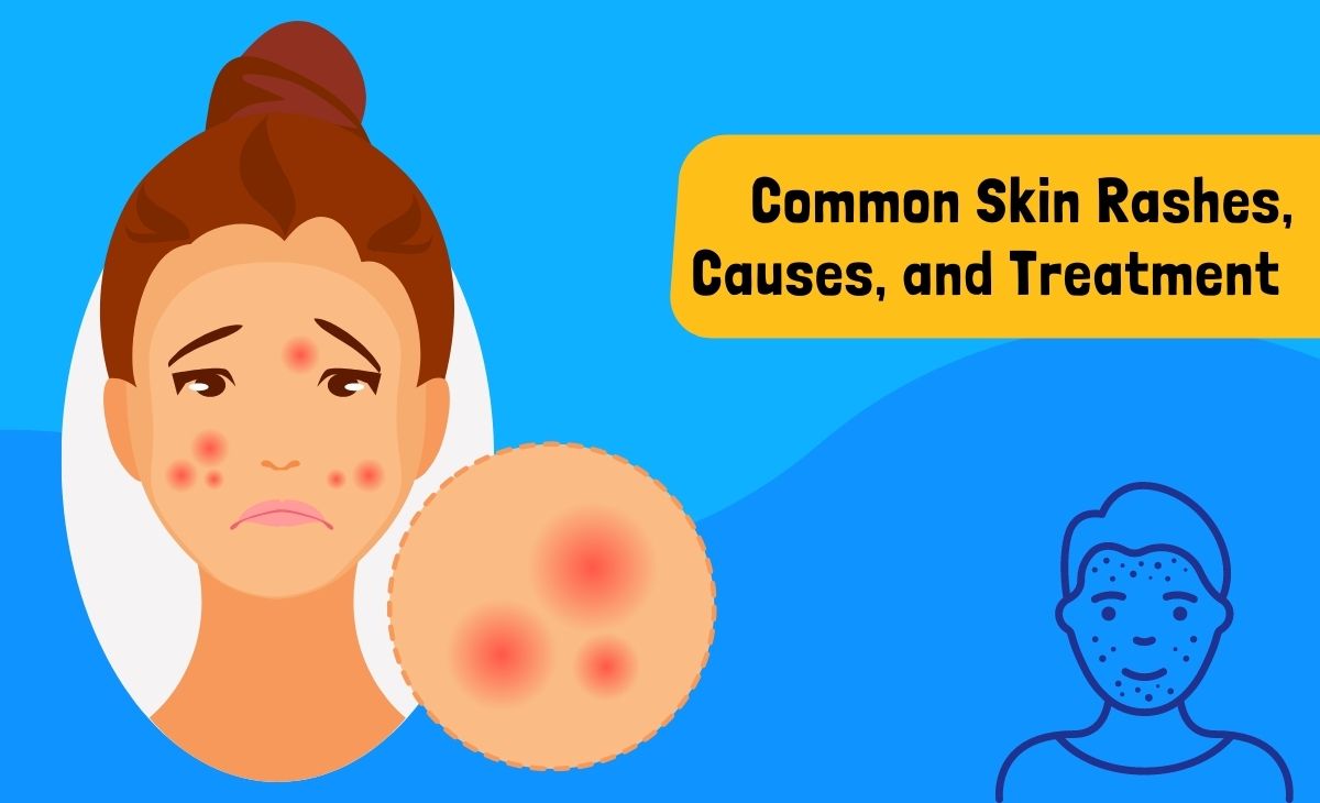 What Is a Skin Rash?