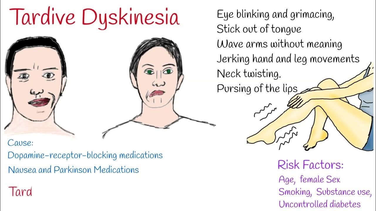 What is Tardive Dyskinesia?