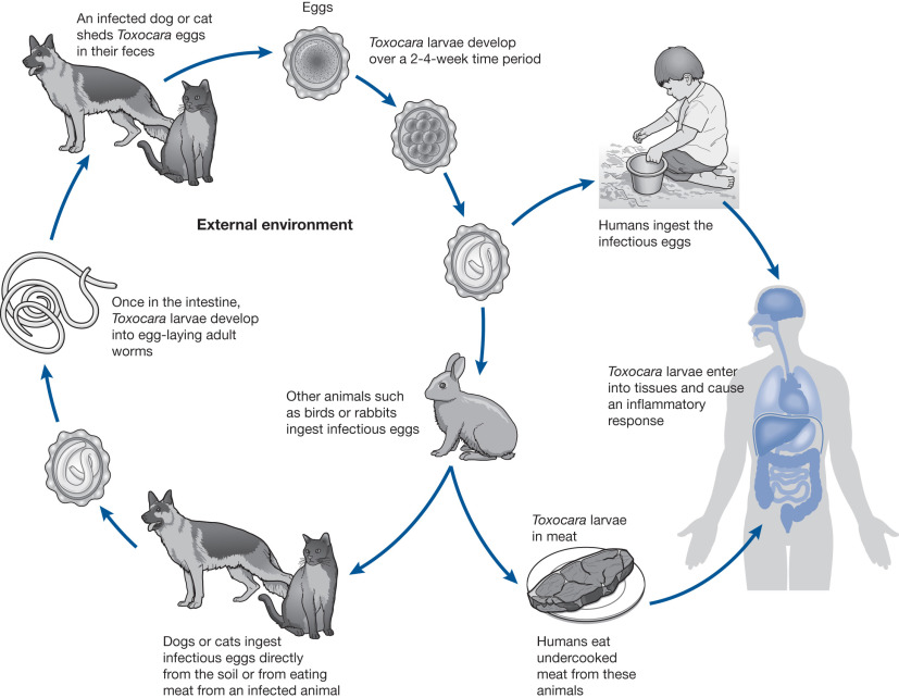What is Toxocariasis?
