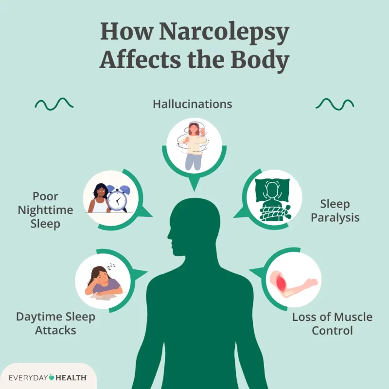 Narcolepsy